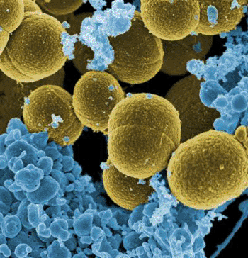 Imagen: La bacteria Staphylococcus aureus (Fotografía cortesía de Tumblr).